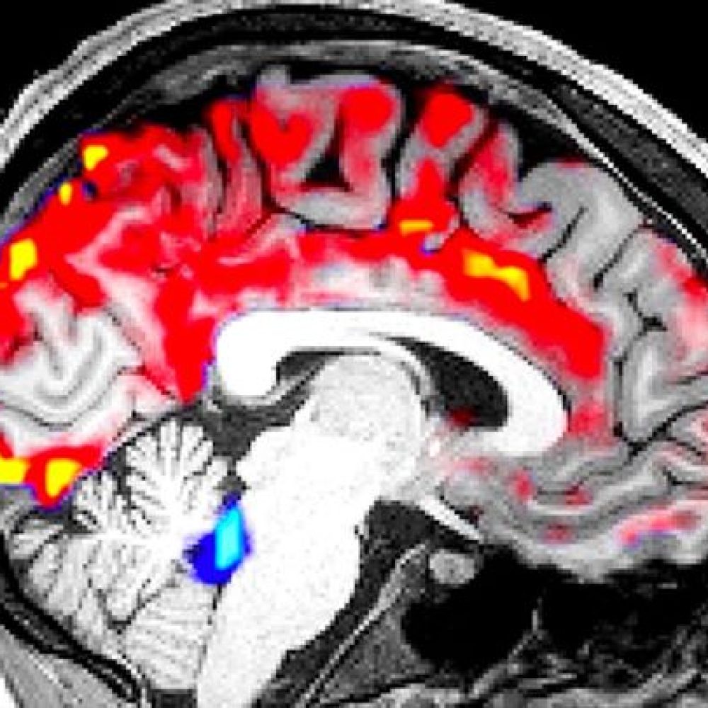 Scientists discovered how this fluid cleans your brain as you sleep, removing to&#8230;